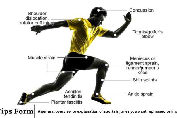 A general overview or explanation of sports injuries you want rephrased or improved?